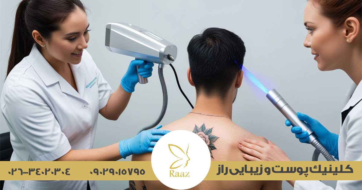 پاک کردن تاتو با لیزر کیوسوییچ در کرج ✨ جدیدترین روش و نتایج واقعی 1 بهترین کلینیک پاک کردن تاتو در کرج