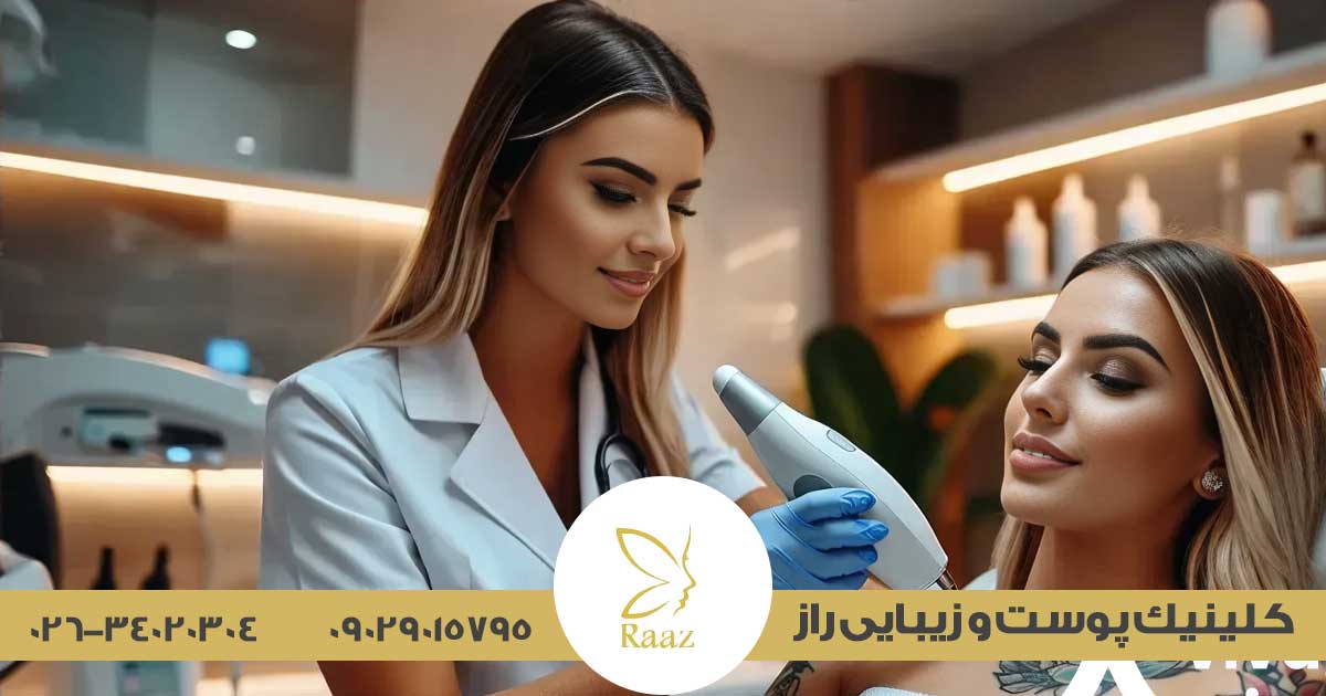 پاک کردن تاتو با لیزر کیوسوییچ در کرج ✨ جدیدترین روش و نتایج واقعی 2 موثرترین روش پاک کردن تاتو در کرج