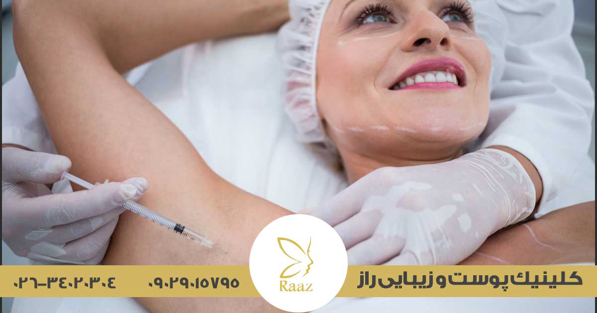 بوتاکس زیربغل در کرج 9 نحوه تزریق بوتاکس زیربغل در کرج، مراحل و مراقبتهای پس از آن