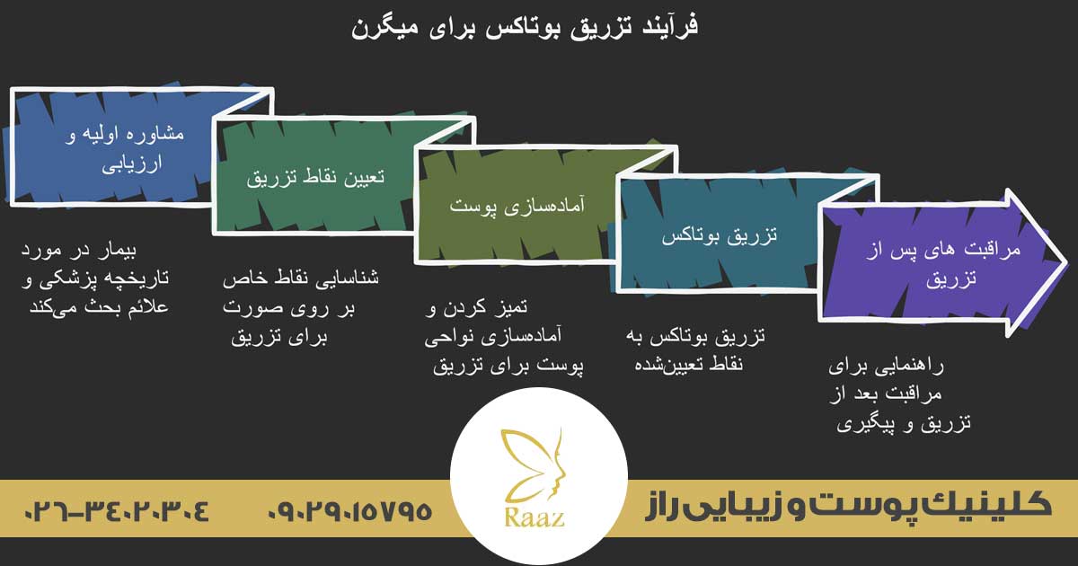 بوتاکس میگرن در کرج 4 تزریق بوتاکس برای میگرن در کرج در کلینیک زیبایی راز