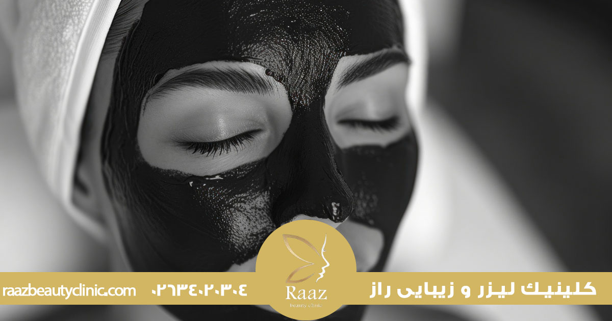 لیزر کربن در کرج 3 هر آنچه باید درباره لیزر کربن صورت در کرج بدانید: از مزایا تا قیمت