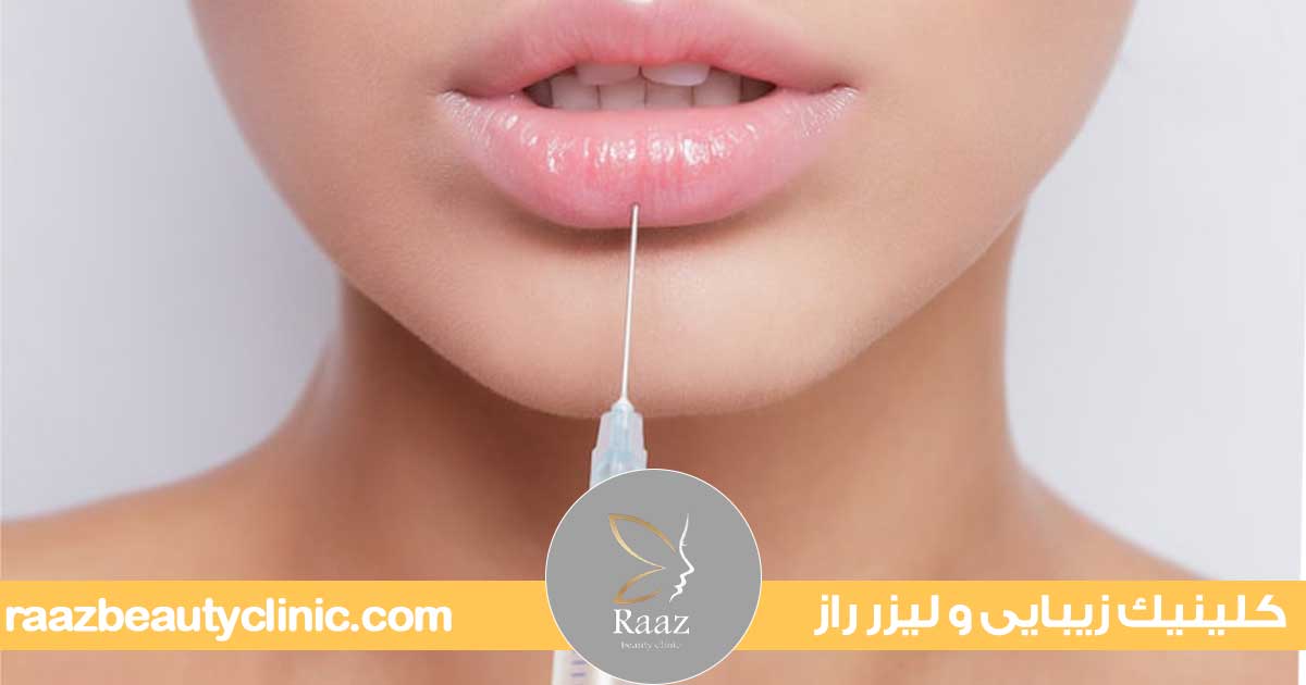 زیبایی لب با تزریق ژل در کرج در کلینیک زیبایی راز با جدیدترین روش ها 1 تزریق ژل لب در کرج کلینیک زیبایی راز