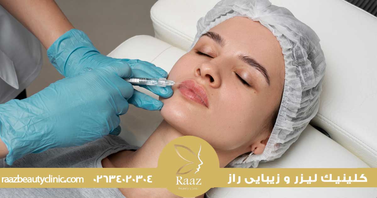 زیبایی لب با تزریق ژل در کرج در کلینیک زیبایی راز با جدیدترین روش ها 5 ژل لب کرج