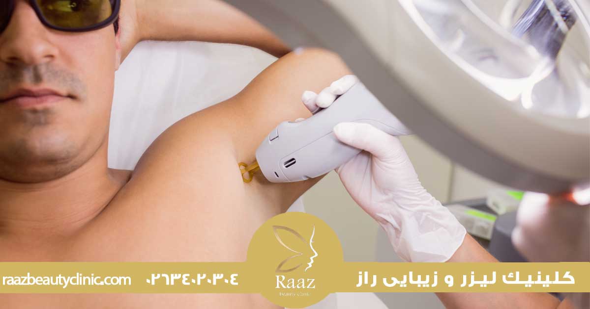جامع ترین راهنمای قیمت لیزر موهای زائد در کرج در سال 1404 2 لیست قیمت لیزر موهای زائد در کرج