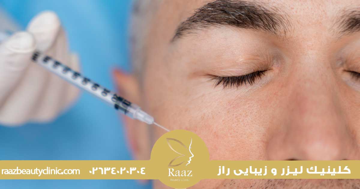 مزونیدلینگ در کرج، راز جوانسازی پوست در کلینیک های معتبر شهر 1 مزونیدلینگ دور چشم در کرج