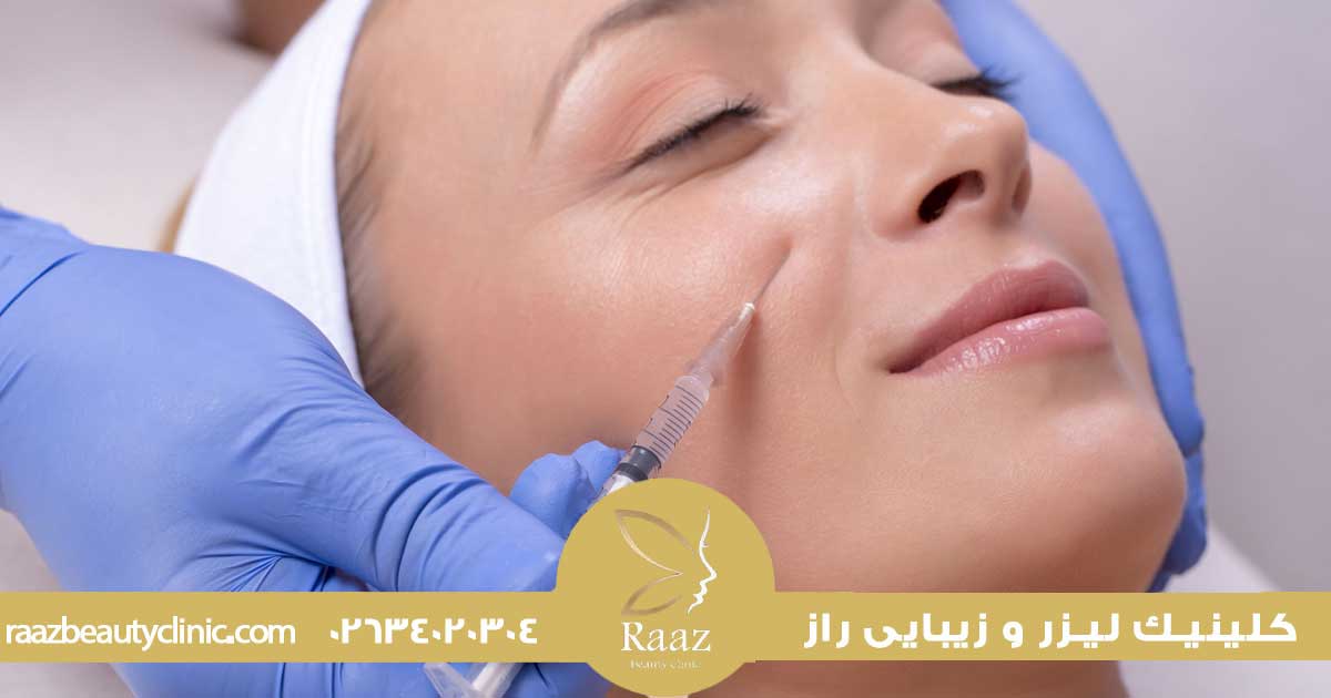 تزریق ژل گونه در کرج ،چگونه گونه های برجسته و طبیعی داشته باشیم؟ 1 نحوه تزریق ژل گونه در کرج