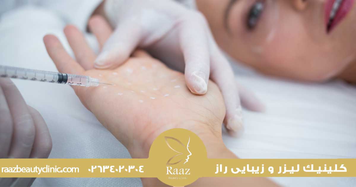 بوتاکس برای تعریق زیاد، روش انجام، میزان اثرگذاری، ماندگاری، هزینه و خطرات واقعی 2 انواع بوتاکس تعریق