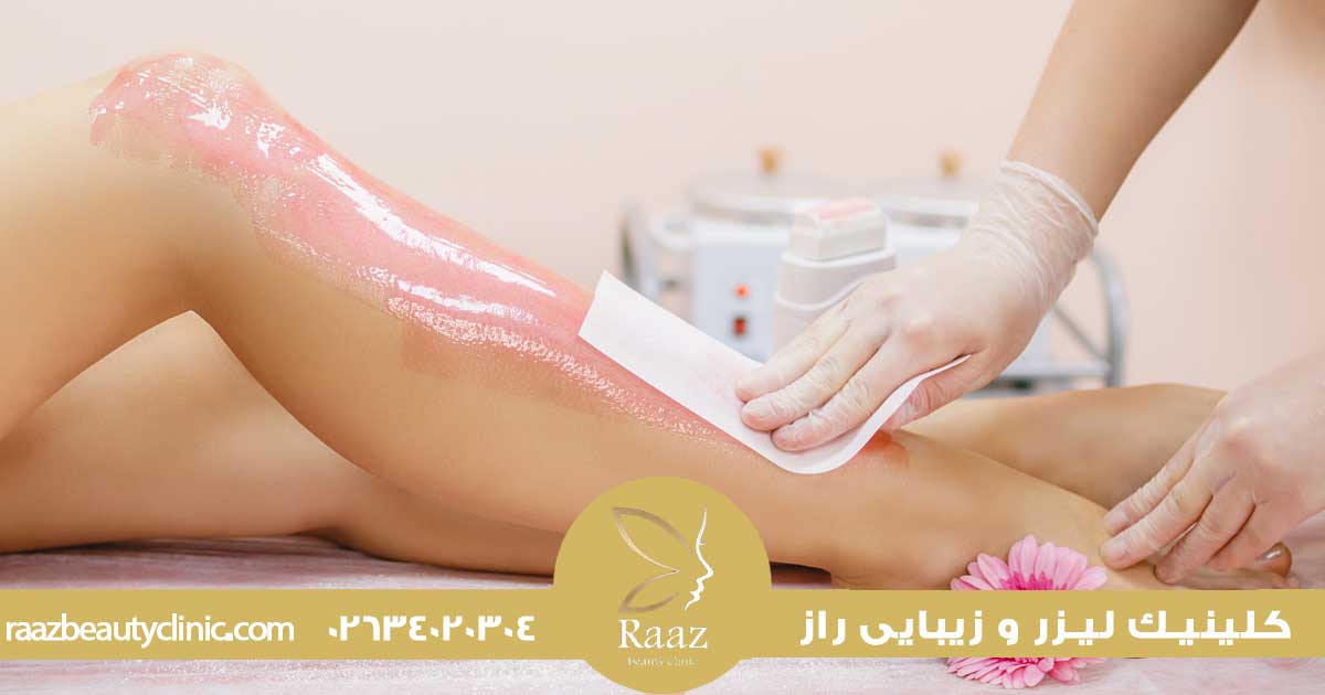 لیزر بهتره یا اپیلاسیون؟ مقایسه واقعی که همه دنبالشن 3 اپیلاسیون بهتره یا لیزر