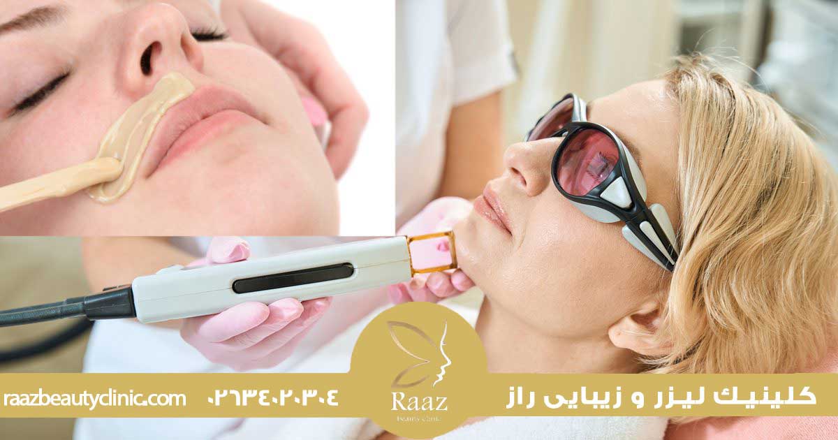 لیزر بهتره یا اپیلاسیون؟ مقایسه واقعی که همه دنبالشن 2 اپیلاسیون یا لیزر