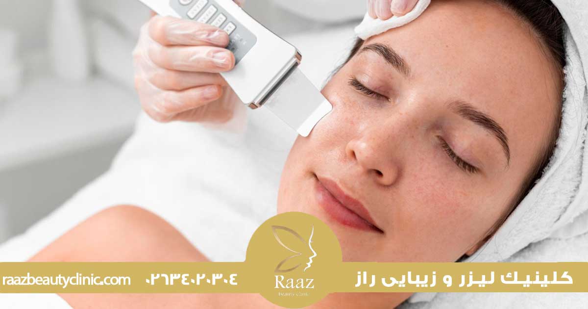 مزایا و معایب استفاده از کربن لیزر برای جوانسازی پوست صورت 4 خواص کربن تراپی صورت