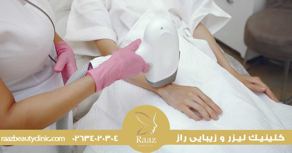 ضخیم شدن مو بعد از لیزر، بررسی علمی عوامل و نکات مراقبتی برای بهترین نتیجه 4 ضخیم شدن موهای کرکی صورت