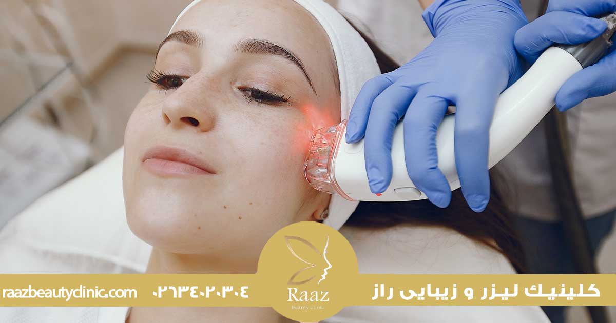 مزایا و معایب استفاده از کربن لیزر برای جوانسازی پوست صورت 5 عوارض پاکسازی صورت با لیزر