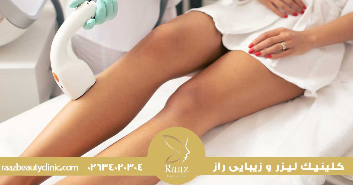 لیزر بهتره یا اپیلاسیون؟ مقایسه واقعی که همه دنبالشن 4 لیزر بهتر است یا اپیلاسیون
