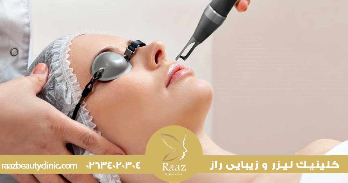 مزایا و معایب استفاده از کربن لیزر برای جوانسازی پوست صورت 2 پاکسازی پوست با لیزر