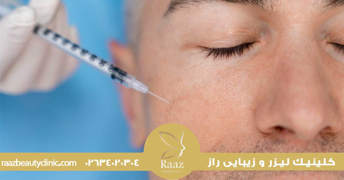 بهترین سن تزریق بوتاکس، چرا الان همه از ۲۵ سالگی شروع میکنن؟ 6 سن بوتاکس پیشانی