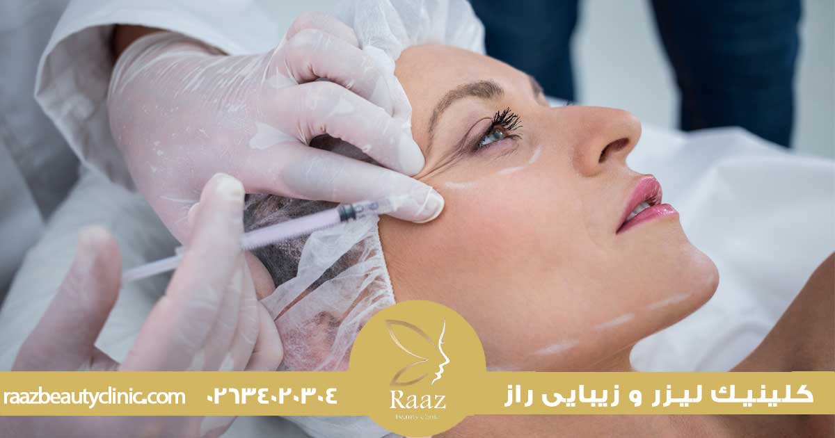 بهترین سن تزریق بوتاکس، چرا الان همه از ۲۵ سالگی شروع میکنن؟ 5 سن مناسب برای تزریق بوتاکس