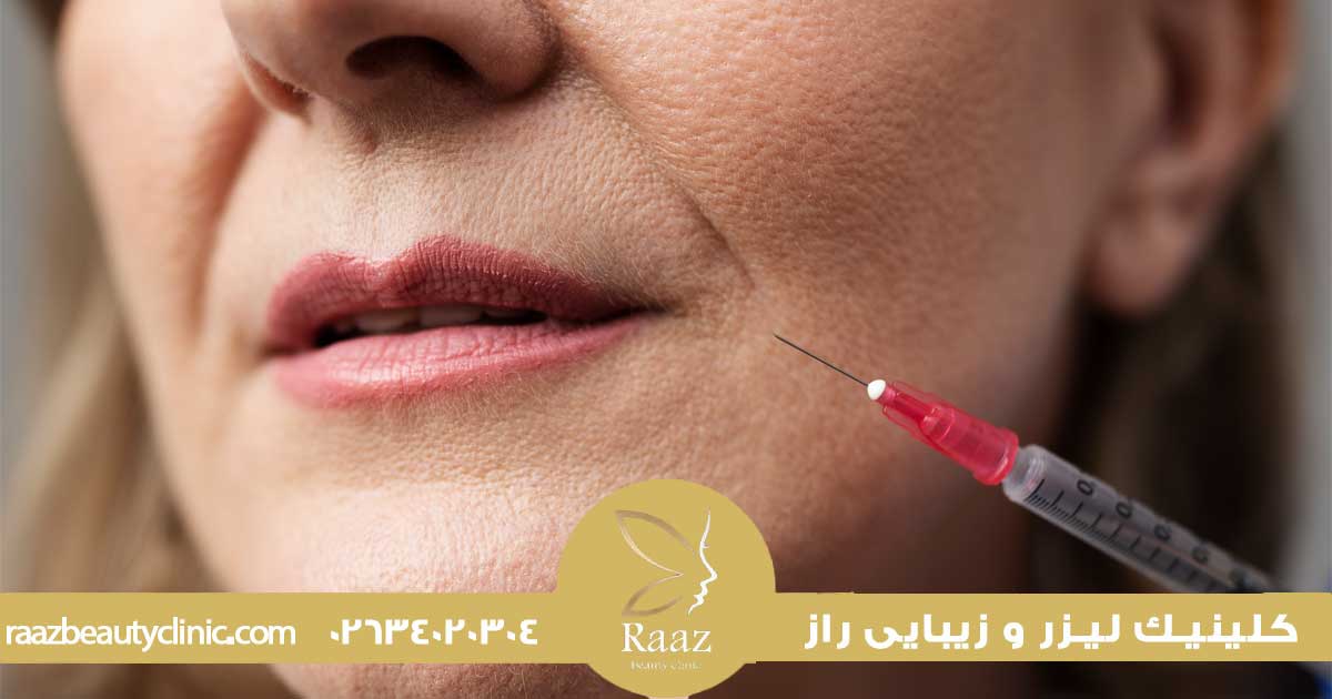 بهترین سن تزریق بوتاکس، چرا الان همه از ۲۵ سالگی شروع میکنن؟ 3 سن مناسب بوتاکس صورت