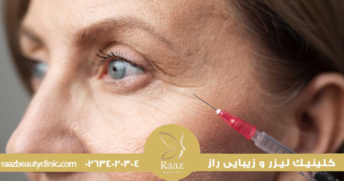 بهترین سن تزریق بوتاکس، چرا الان همه از ۲۵ سالگی شروع میکنن؟ 2 سن مناسب تزریق بوتاکس