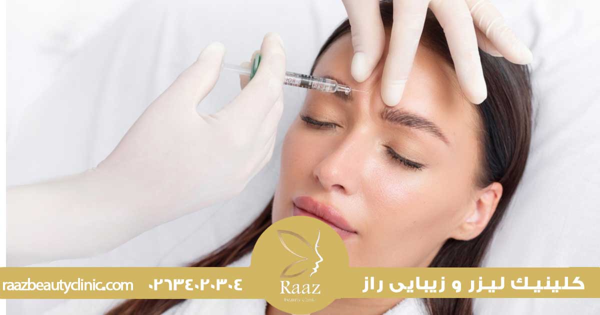 بوتاکس چقدر ماندگاره؟ چرا برای بعضیا ۶ ماهه، بعضیا ۲ ماهه؟ 4 بوتاکس صورت بعد از چند روز اثر می کند