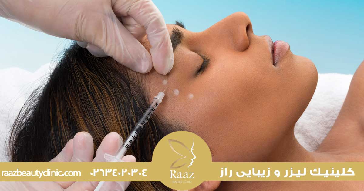 بوتاکس چقدر ماندگاره؟ چرا برای بعضیا ۶ ماهه، بعضیا ۲ ماهه؟ 5 بوتاکس چقدر ماندگاری دارد