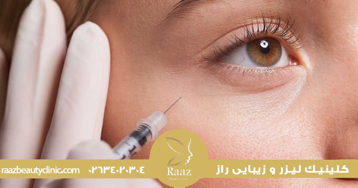 بوتاکس چقدر ماندگاره؟ چرا برای بعضیا ۶ ماهه، بعضیا ۲ ماهه؟ 3 بوتاکس چند روزه اثر میکند