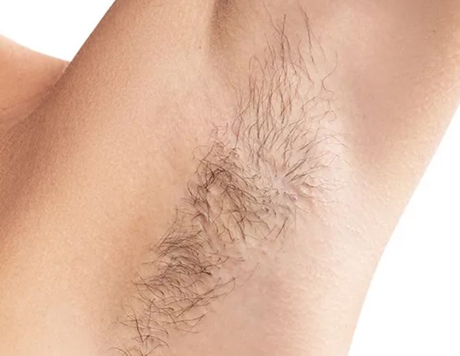 کلینیک زیبایی راز 28 کلینیک زیبایی راز مرکز لیزر موهای زائد