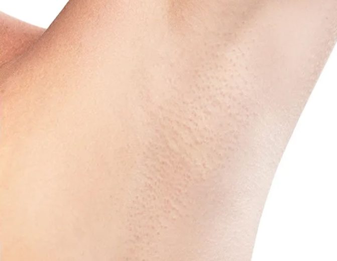 کلینیک زیبایی راز 29 کلینیک زیبایی راز مرکز لیزر موهای زائد در کرج