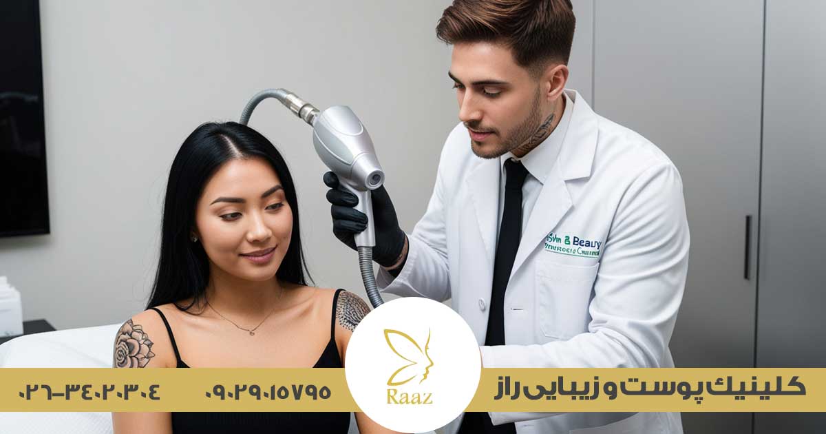 پاک کردن تاتو در کرج
