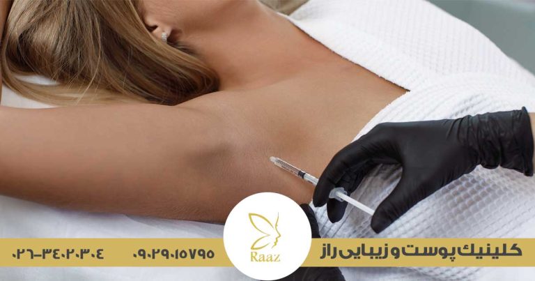 بوتاکس زیربغل در کرج 1 بوتاکس زیربغل در کرج