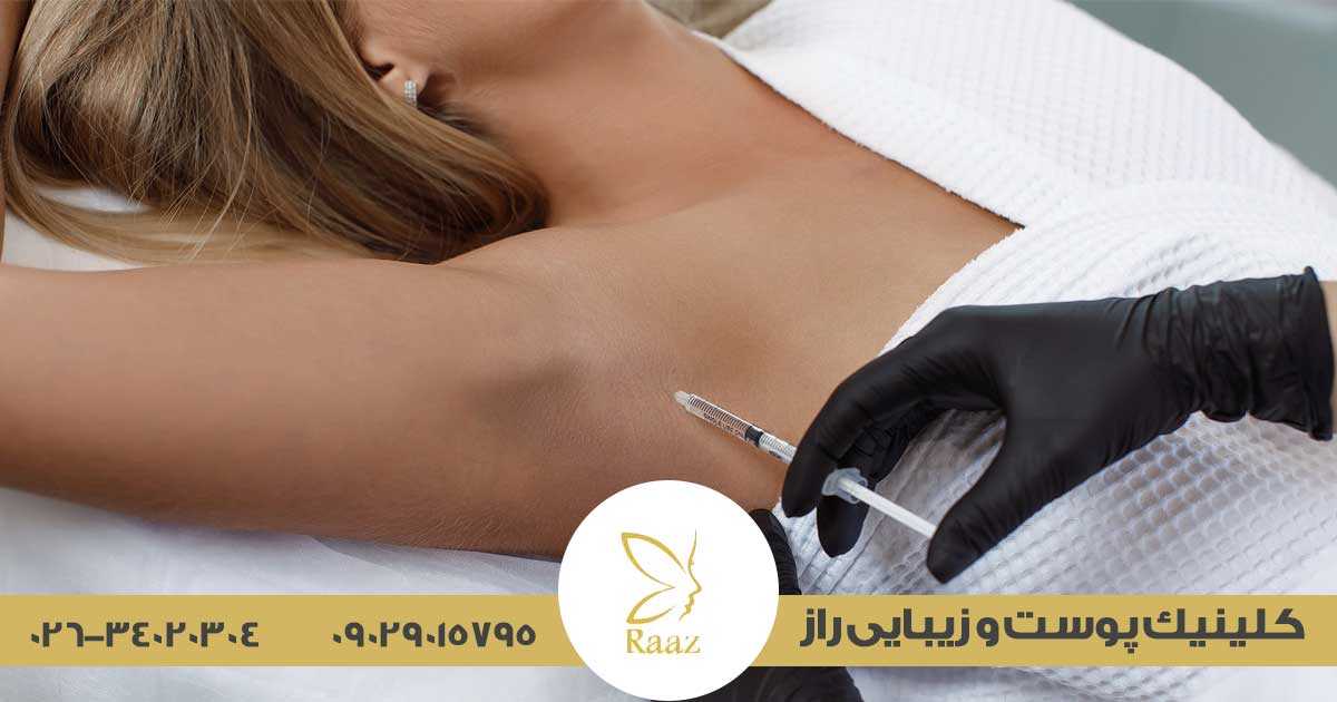 بوتاکس زیربغل در کرج