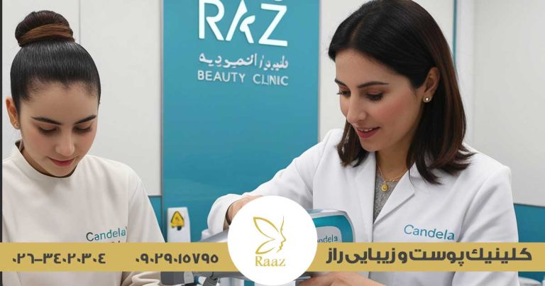 لیزر موهای زائد در کرج با دستگاه کندلا 11 لیزر موهای زائد در کرج