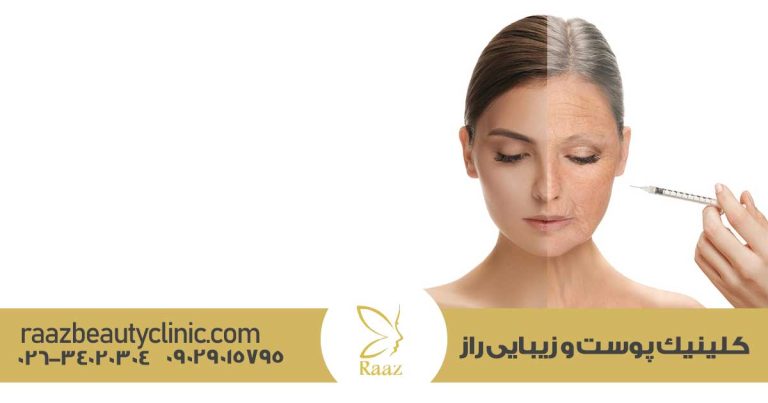 پروفایلو در کرج 29 پروفایلو در کرج