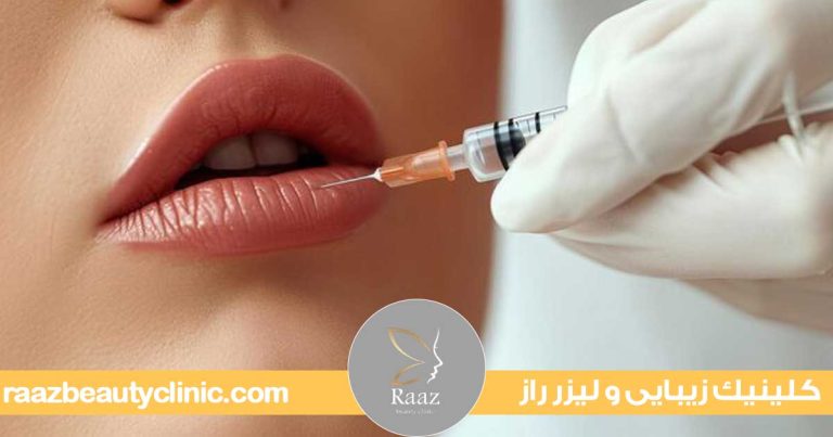 زیبایی لب با تزریق ژل در کرج در کلینیک زیبایی راز با جدیدترین روش ها 9 تزریق ژل لب در کرج