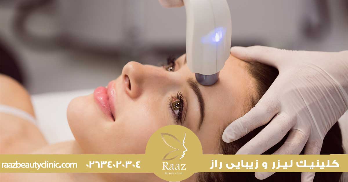 دستگاه لیزر موهای زائد