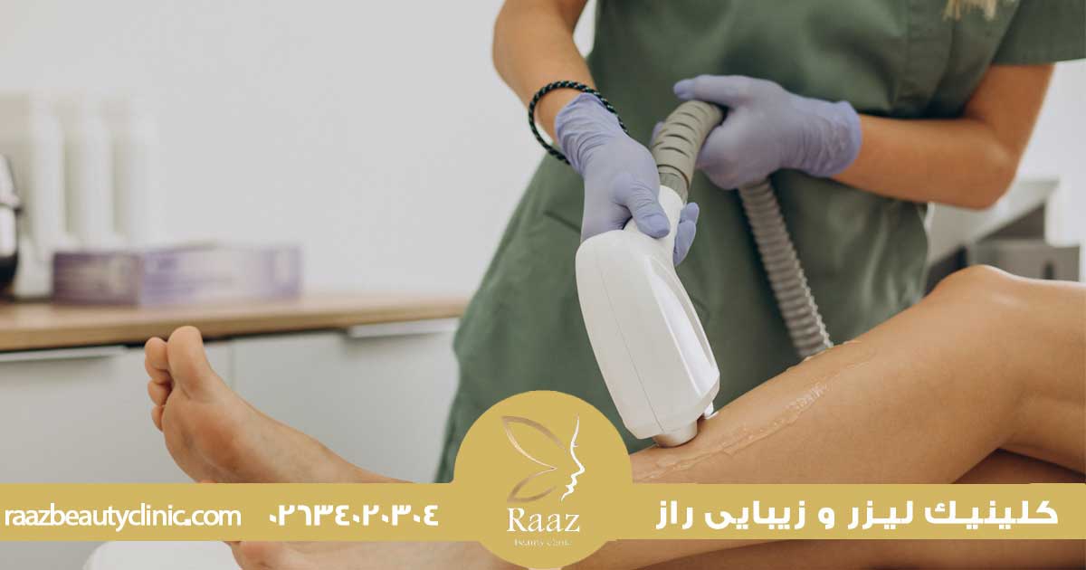لیزر موهای زائد