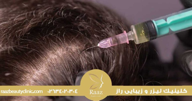 همه چیز درباره مزوتراپی در کرج؛ از جوانسازی پوست تا درمان ریزش مو 23 مزوتراپی در کرج