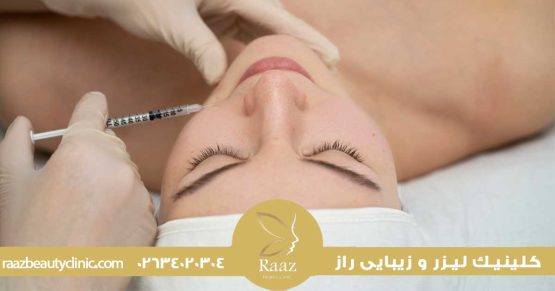 تزریق ژل چانه در کرج با کلینیک لیزر راز، فرم دهی طبیعی و متناسب با چهره 14 ژل چانه در کرج