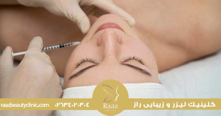 تزریق ژل چانه در کرج با کلینیک لیزر راز، فرم دهی طبیعی و متناسب با چهره 4 ژل چانه در کرج