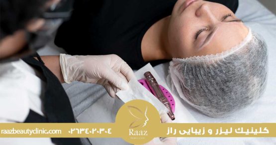 مزونیدلینگ در کرج، راز جوانسازی پوست در کلینیک های معتبر شهر 22 مزونیدلینگ در کرج