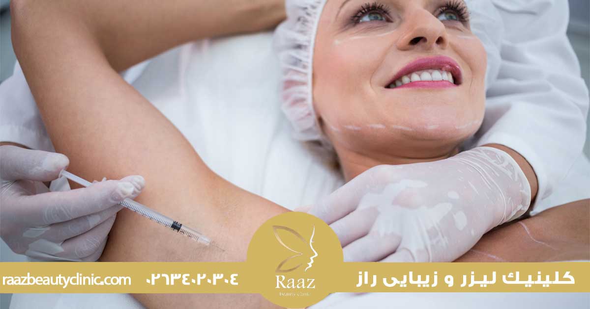 بوتاکس تعریق