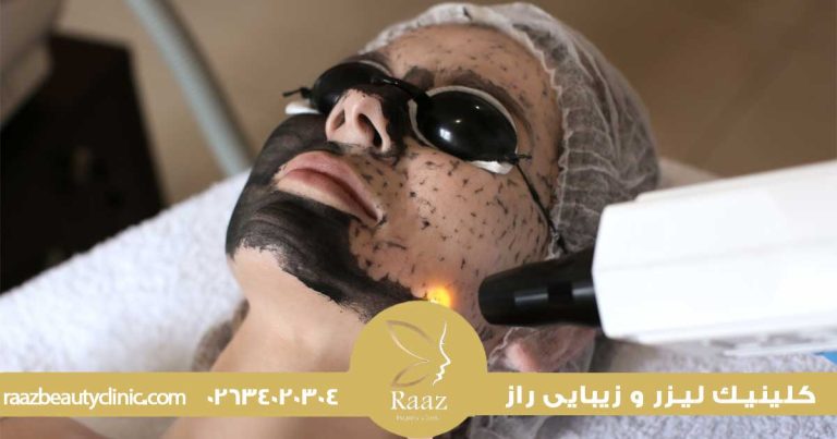 مزایا و معایب استفاده از کربن لیزر برای جوانسازی پوست صورت 1 پاکسازی صورت با لیزر