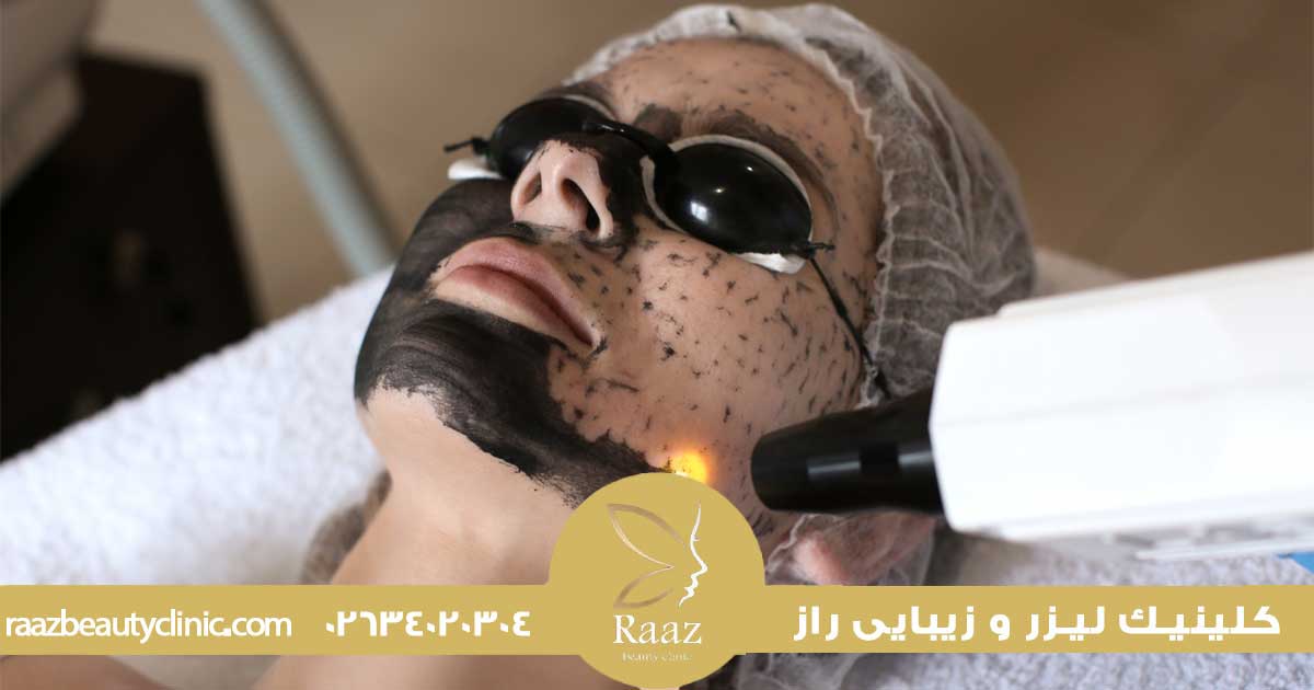 دریافت نوبت 14 پاکسازی صورت با لیزر